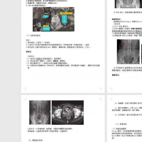 最新医学影像复试备考资料，覆盖放射学与超声医学，适用于期末复习