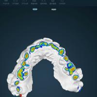 三维口腔模型分析工具
