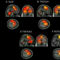 医学影像处理：静息态fMRI数据的功能连接分析教程