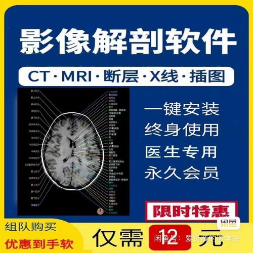 中文版e-anatomy（影像解剖图谱）- 人体断层解剖图像大全