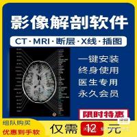 中文版e-anatomy（影像解剖图谱）- 人体断层解剖图像大全